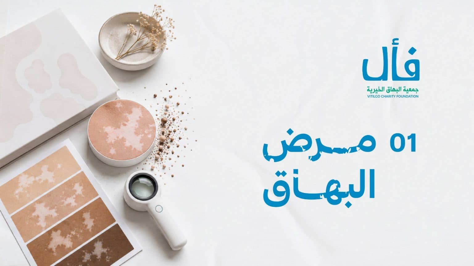 ما هو البهاق؟ وما علاجة؟