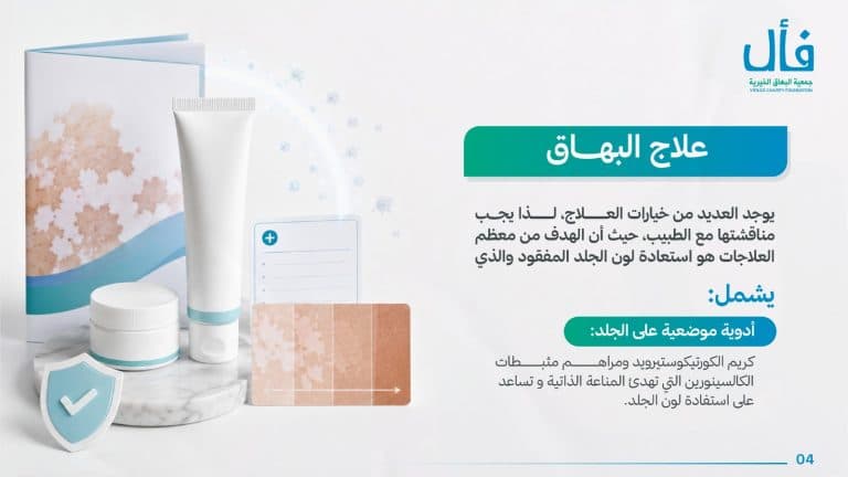 ما هو البهاق؟ وما علاجة؟