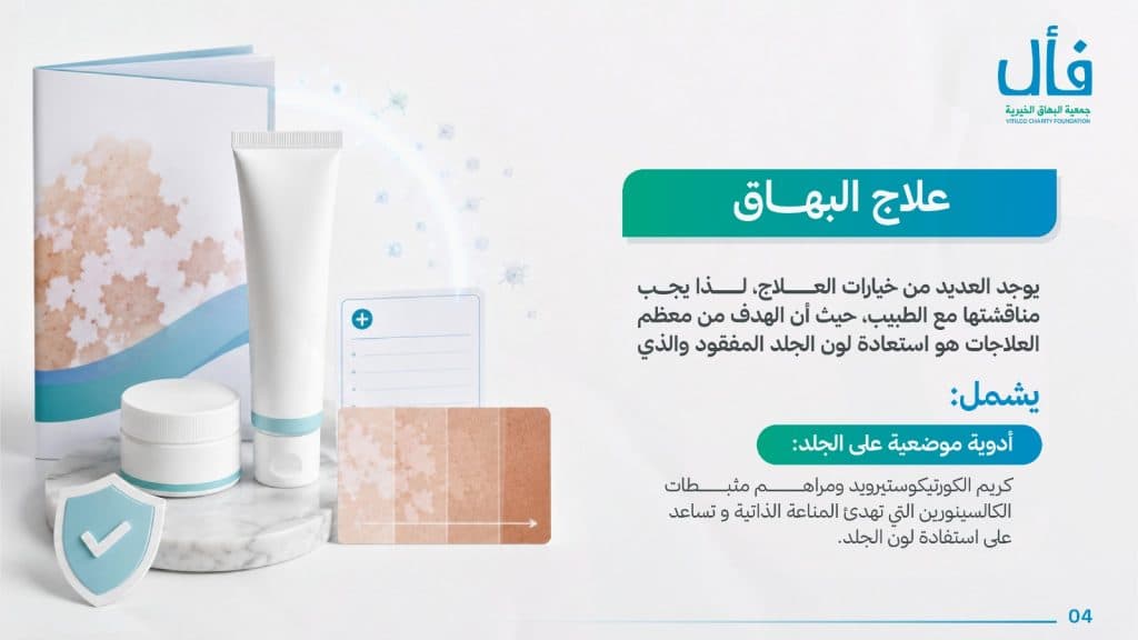 ما هو البهاق؟ وما علاجة؟