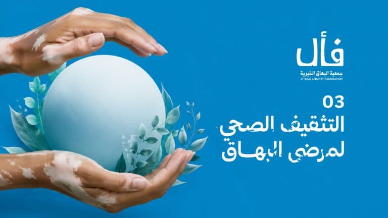 ما هو البهاق؟ وما علاجة؟
