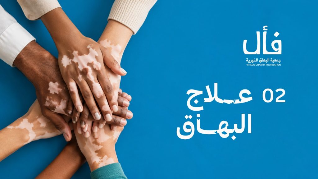ما هو البهاق؟ وما علاجة؟